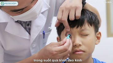 [GIẢI PHÁP] Xóa cận thị, loạn thị || KHÔNG phẫu thuật || Cải thiện thị lực tới 10/10 || Kính Ortho-K