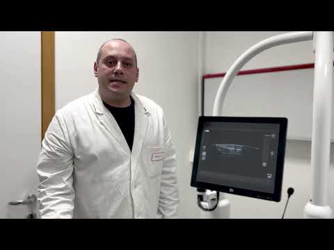 Intelligenza artificiale per diagnosi precoci del tumore al seno: innovativo software al Policlinico