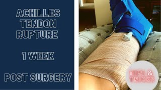 Achilles Tendon Rupture | 1 Week | POST SURGERY | 2021