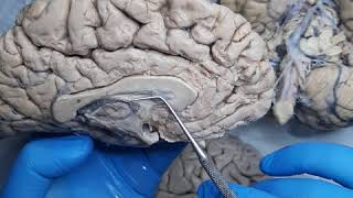 Анатомія кінцевого мозку, функції кори