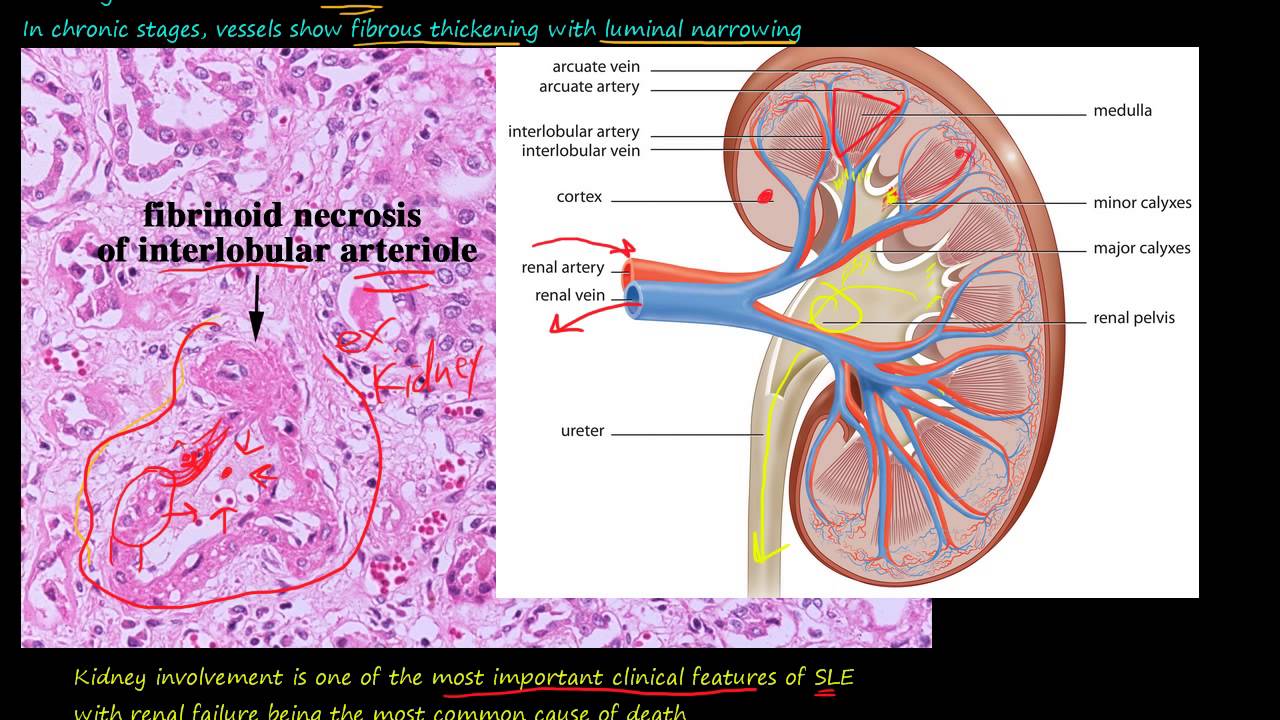 Nafra1705 – intervensimisikecil