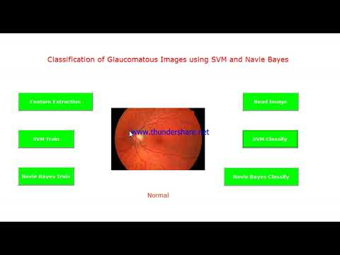 Glaucoma Detector