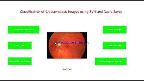 Glaucoma Detector