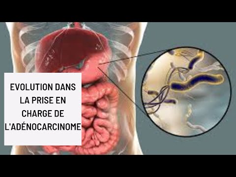 Vidéo: Lymphangiogenèse Et Angiogenèse Au Cours Du Développement Du Pancréas Fœtal Humain