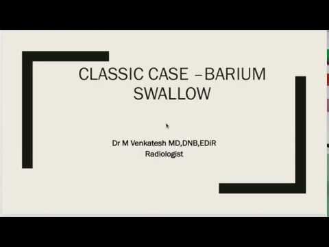 Video: Is barium sluk beter as endoskopie?