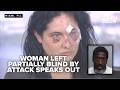 Woman left partially blind in brutal downtown Miami attack speaks out