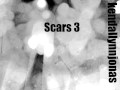 Scars 3