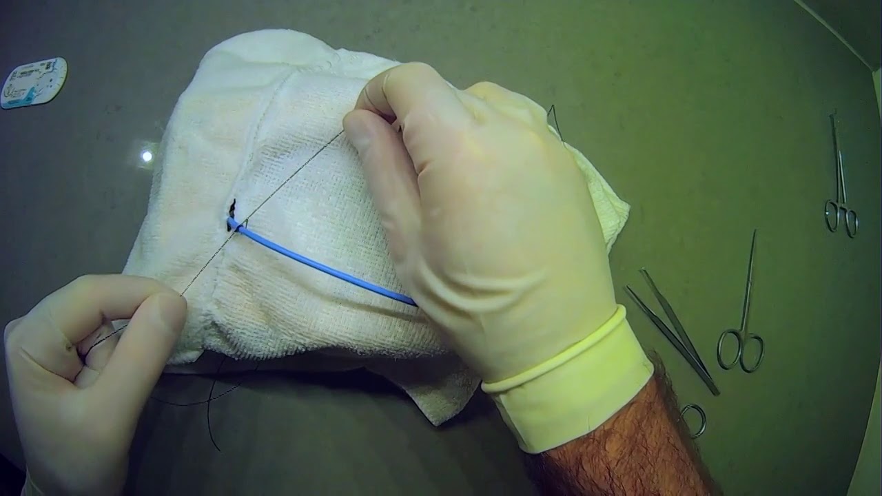 02 Зашивание трубки на месте