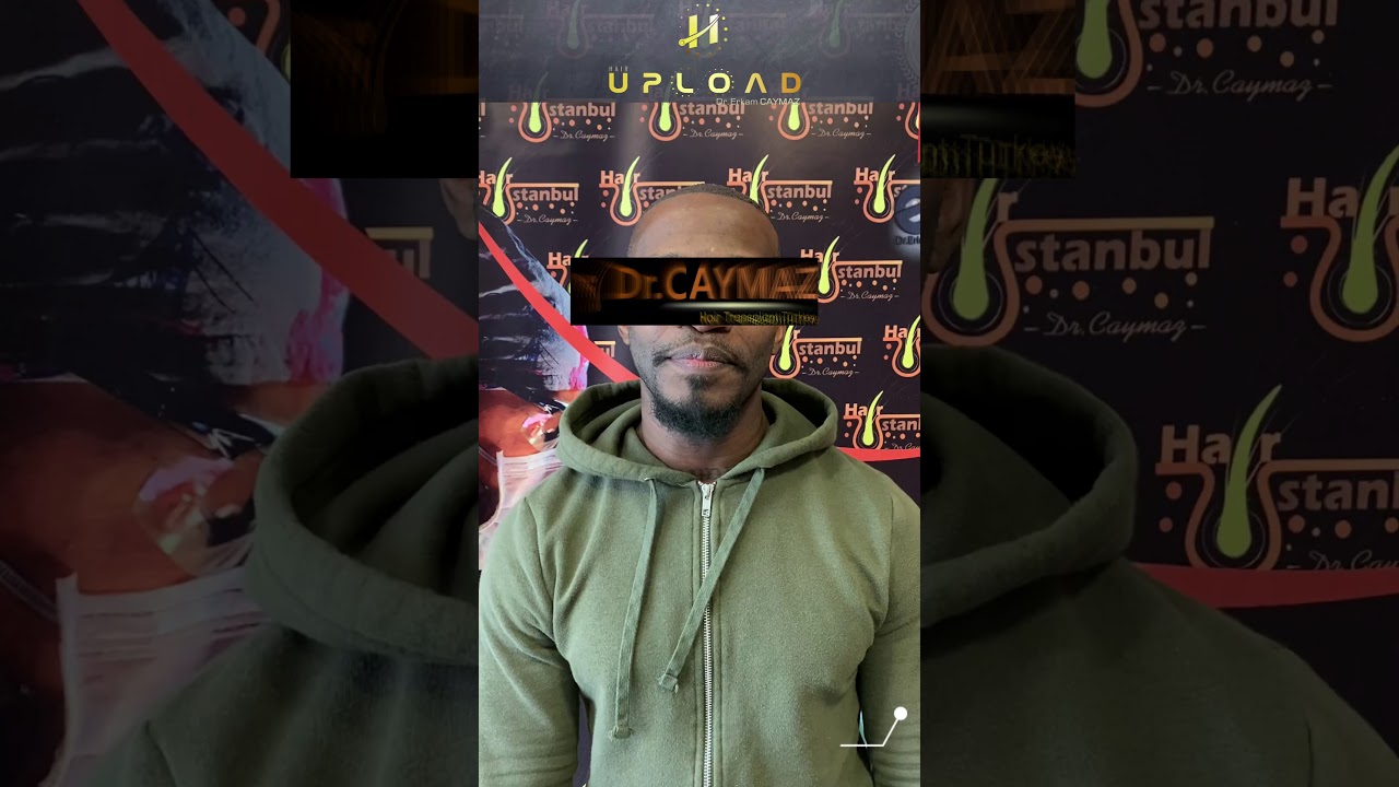 Mr Private - 3000 Graft USA | Hair Transplant 