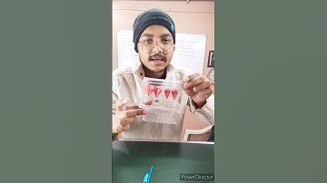 class 10th maths ncert chapter 13 exercise 13.2 question no.4 #maths #cbse #ncert