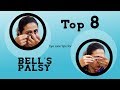 Top 8 Eye care tips for BELL'S PALSY