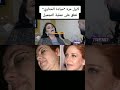 لأول مرة ميادة الحناوي تعلق على عملية التجميل