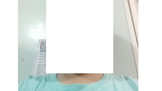 ExplodingTnT's Face Reveal 😱😱😱😱
