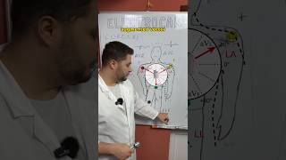 Ecg  Avf Explained  medicalstudent medical medicaleducation futuredoctor cardiology ecg
