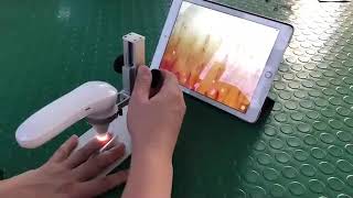 Abeltech Hd Nailfold Capillaroscopy