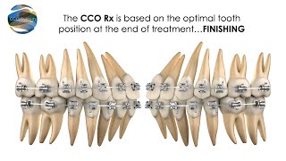 Achieving Work-Life Balance in Orthodontics: Unlocking the Power of the CCO System WEBINAR