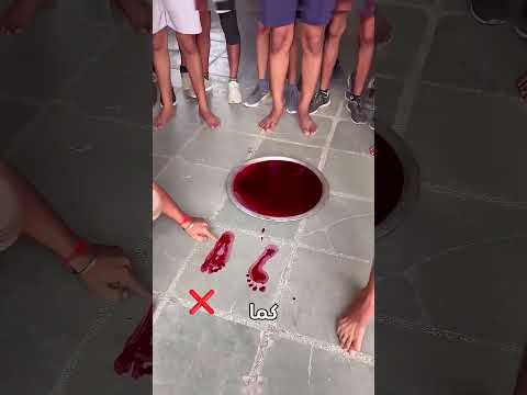 الجيش يرفض هؤلاء بسبب شكل أقدامهم 