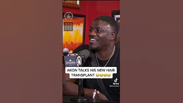 AKON Speaks On Getting Hair Transplant Procedure In Turkey 