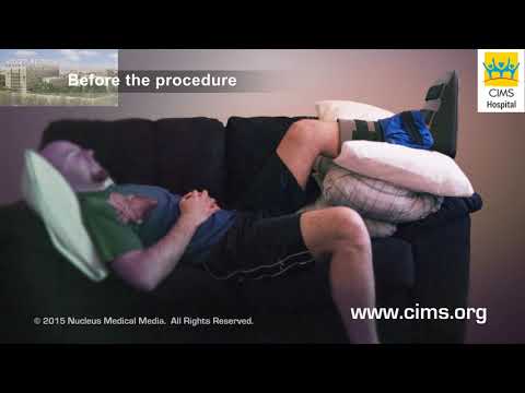 Ankle Fracture Repair  (Hindi) - CIMS Hospital