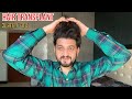 My hair transplant results after 3 years  my hair transplant cost medicine care experience 