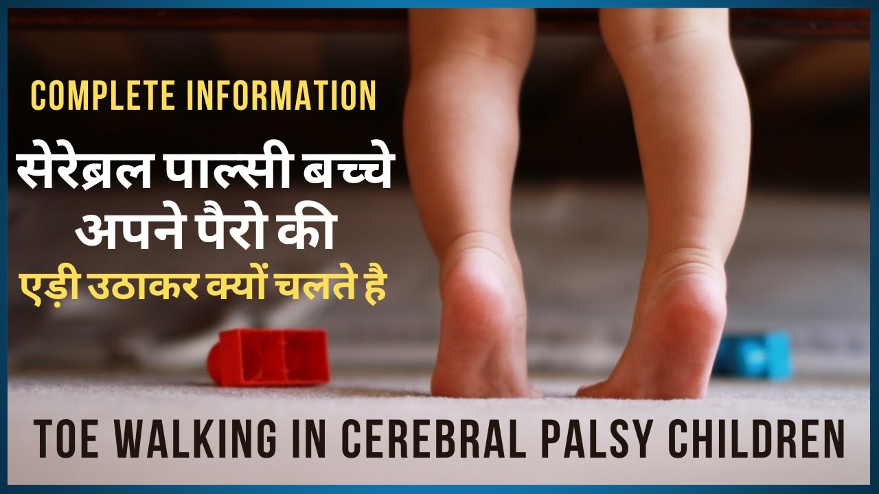 Toe Walking in cerebral palsy Children | सेरेब्रल पाल्सी बच्चे अपने पैरो की एड़ी उठाकर क्यों  चलते है