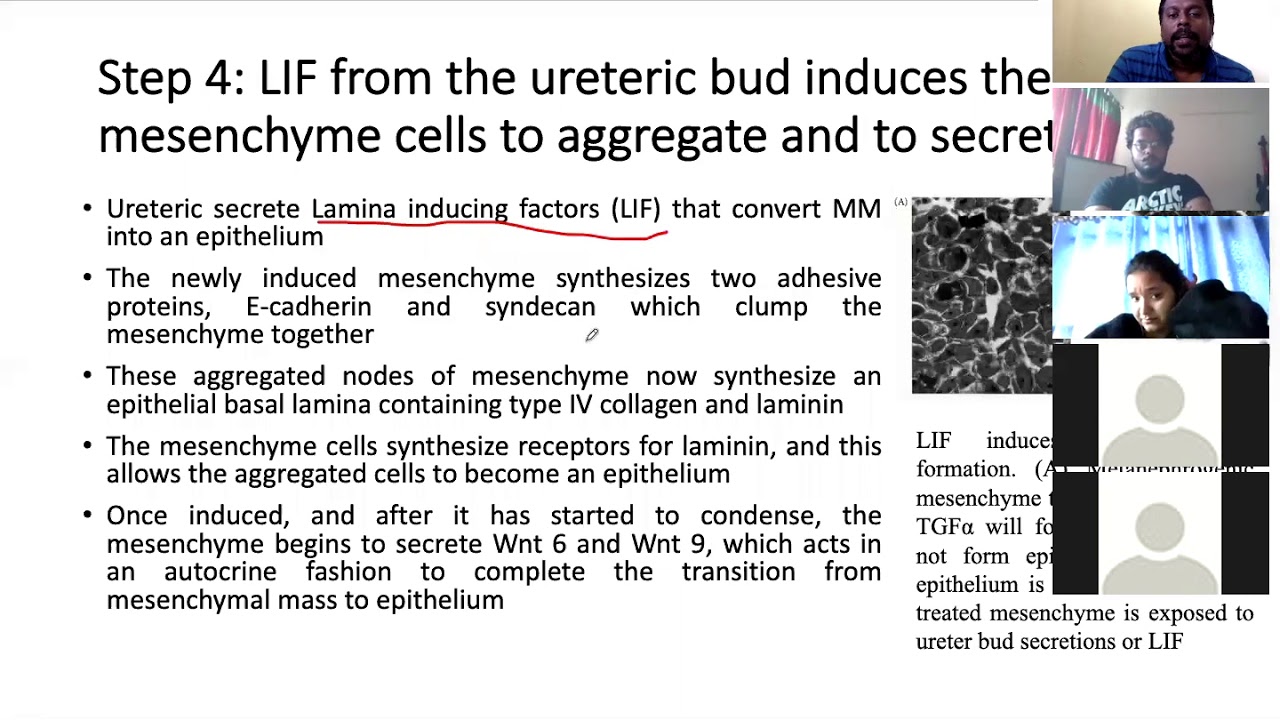 Kidney development part 2