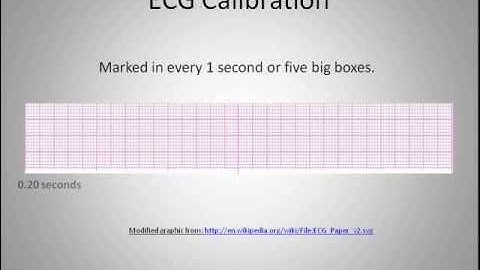 ECG Interpretation Video Lecture  Module 2 of 6