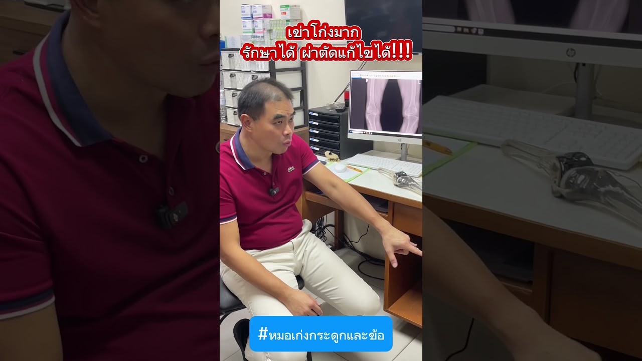 เข่าโก่งมาก รักษาได้แก้ไขได้ !! #หมอเก่งกระดูกและข้อ #เข่าโก่ง #ข้อเข่าเสือม #ปวดเข่า #ข้อเสื่อม