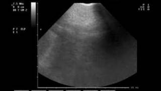 Ultrasound screening of mudi puppies by Birkabosszanto 2,726 views 16 years ago 4 minutes, 21 seconds