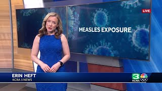 Hundreds possibly exposed to measles at UC Davis medical center, officials warn