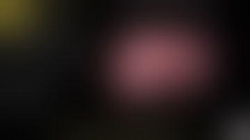 LAPAROSCOPIC SPLEEN-PRESERVING DISTAL PANCREATECTOMY: A VIDEO PRESENTATION