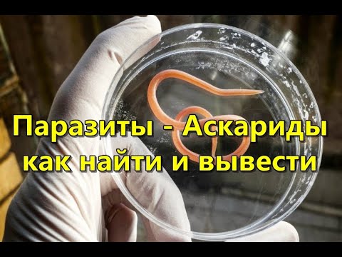 Паразиты - Аскариды как найти и вывести