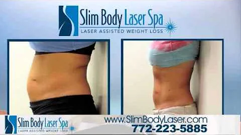 How does the Lipo Laser Work | Learn why Laser Lipo is the safe Liposuction alternative