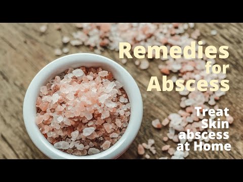 Home Remedies for Abscess - 3 Safe Ways to Treat Skin Abscess at home?