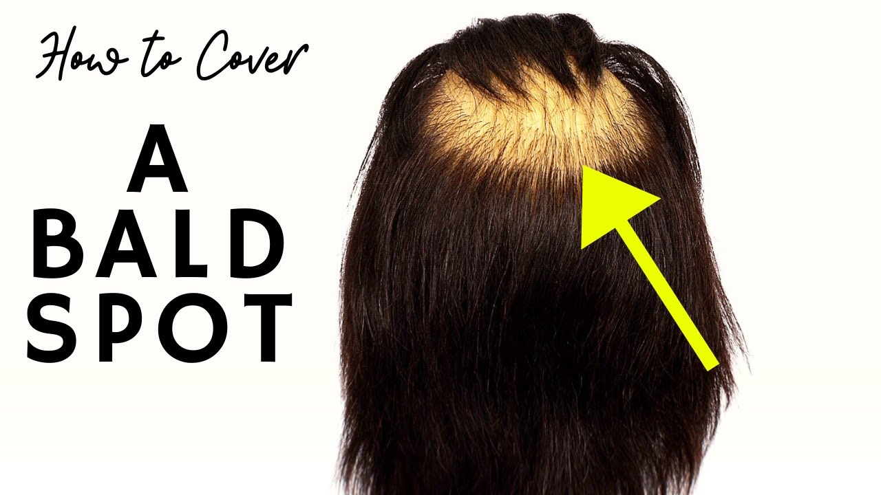 How to Fix a Bald Spot - TheSalonGuy - thptnganamst.edu.vn