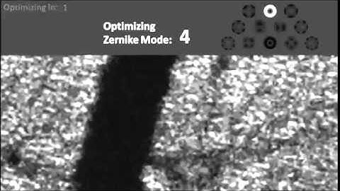 In vivo imaging of human photoreceptor mosaic with wavefront sensorless adaptive optics optical...