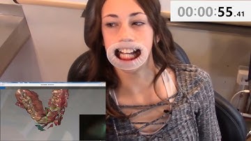 scanner intraorale CS 3600