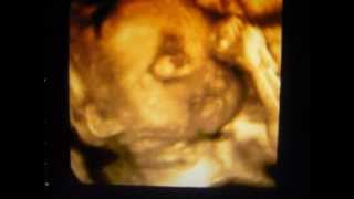 Bb Sofia Eco 26 Semanas