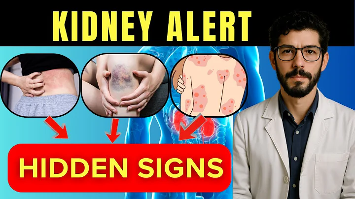 17 Early Warning Signs of Kidney Disease You Must Notice: Doctor Explains