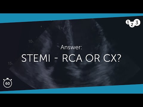 60 Seconds of Echo Teaching Answer: STEMI - RCA or CX?