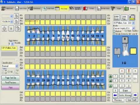 Dentrix Perio Charting Video