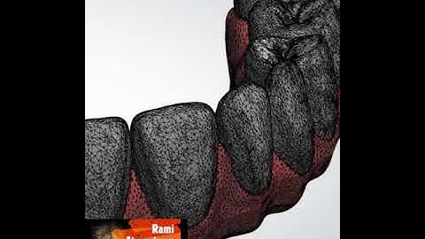 3Shape Smart way & more productivity