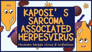 Kaposi Sarcoma Associated Herpes virus (HHV 8): Morphology, Diagnosis, Treatment & Prevention