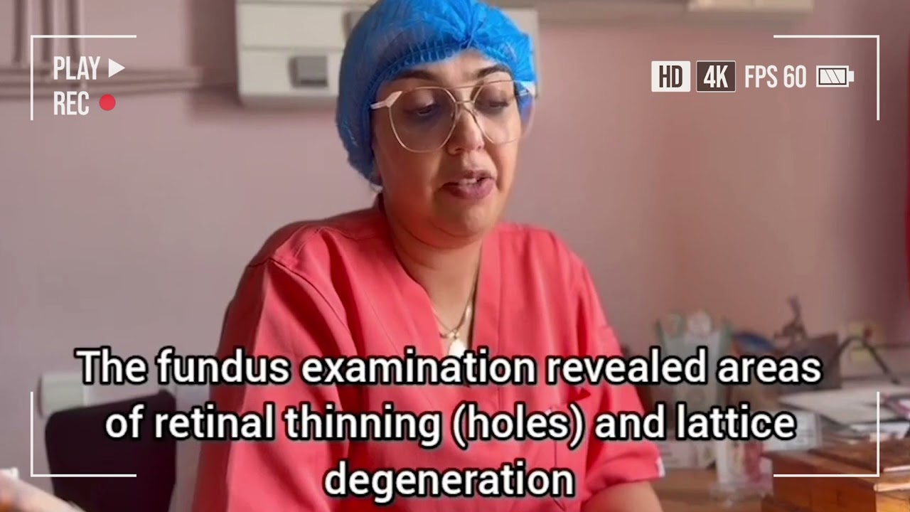 How Are Challenging Intraocular Lens Cases Managed? | Insights from Dr. Morocco #eyecrylphakic