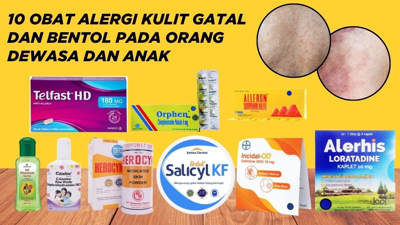 10 Obat Alergi Kulit Gatal dan Bentol - YouTube