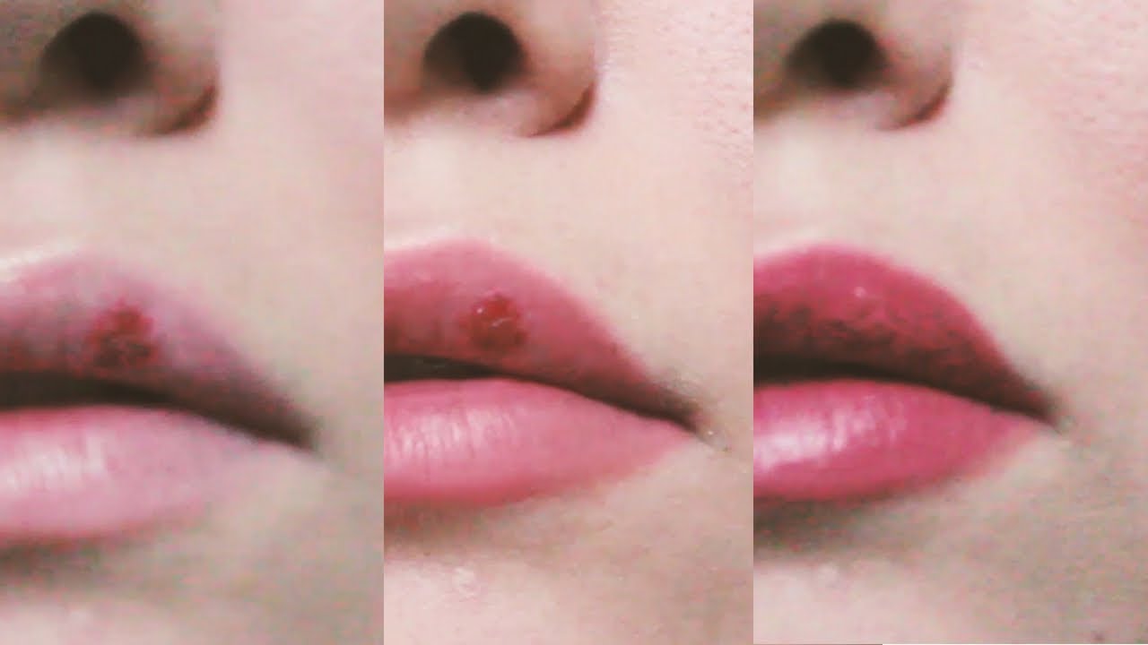 How to conceal and clean a COLD SORE YouTube