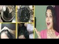 सफेद बाल काले करने के लिए लगाएं ये Natural Hair Dye | Color Grey Hair Naturally