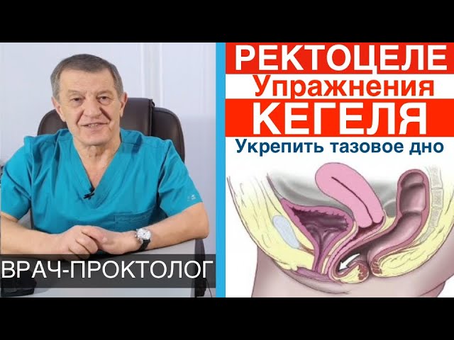 Лев карапетович проктолог. Ректоцеле упражнения и гимнастика. Проктология- ректоцеле. Ректоцеле упражнения кегеля.