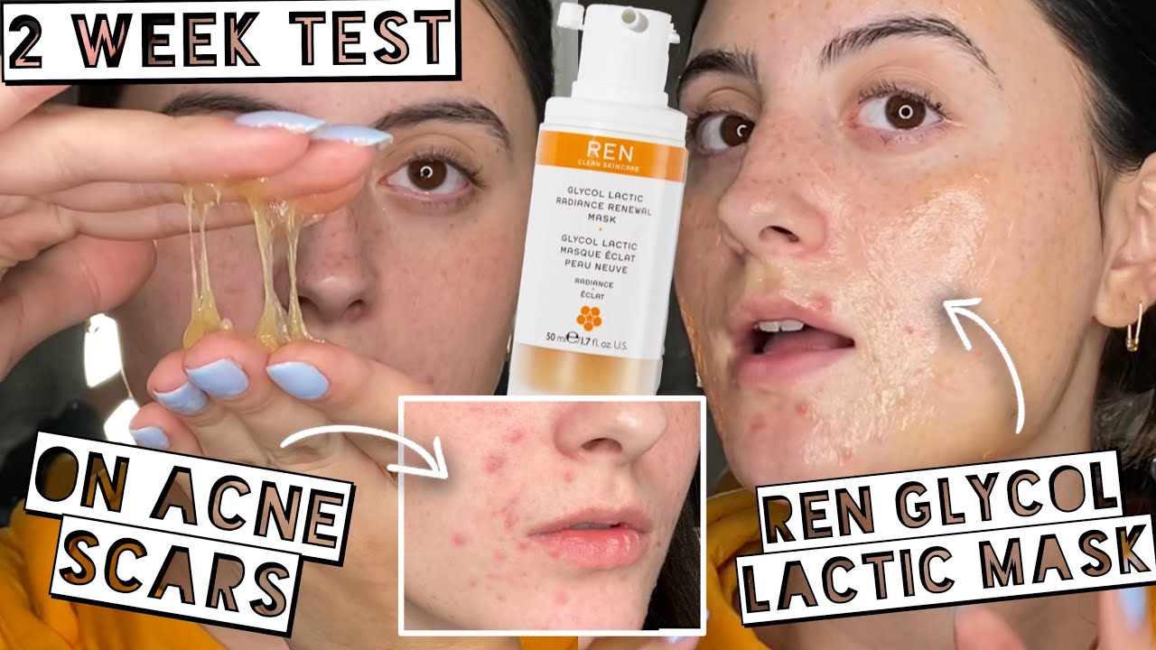 TESTING $58 GLYCOL LATIC RADIANCE RENEWAL MASK FOR 2 WEEKS FOR ACNE - YouTube