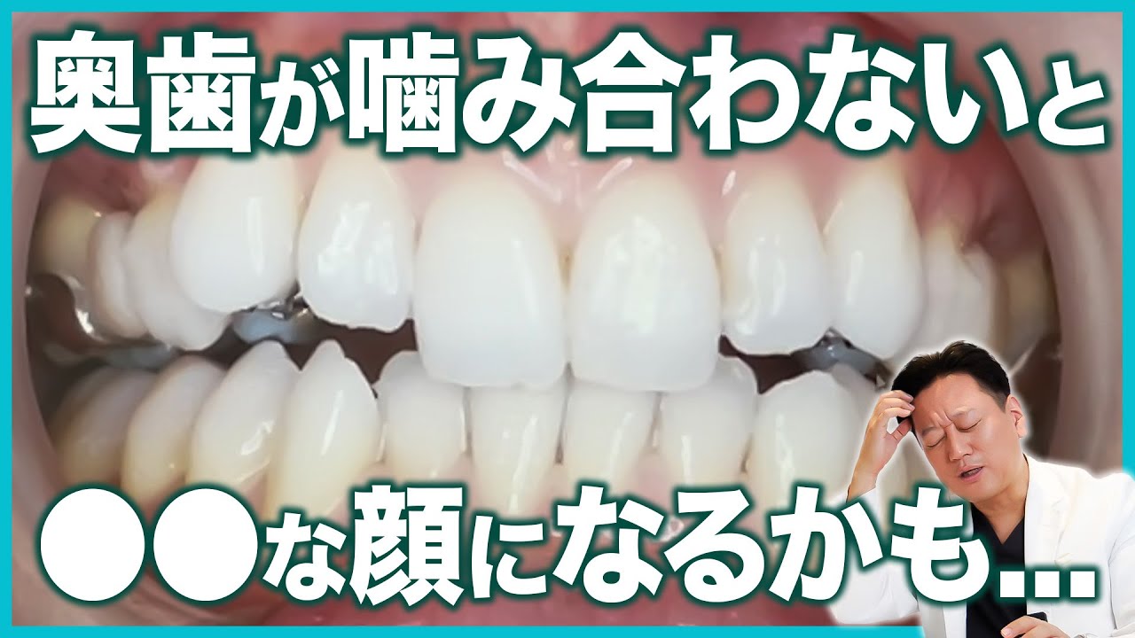 バイトアップってなに？上下の歯が噛み合わない時の矯正で行う治療方法を解説します【審美歯科 歯列矯正 歯並び】